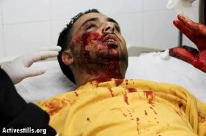 Mohammad al-Azza, fotógrafo palestino, herido el 8 de abril por un soldado israelí que le disparó cuando cubría una incursión en el campo de refugiados de Aida, Belén. (Activestills).